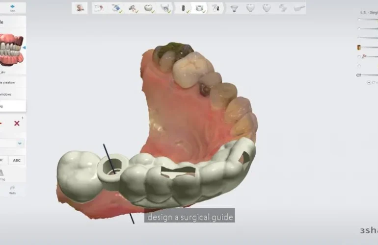 3shape-mkg-uniqum-3d